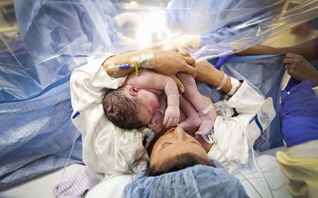 சிசேரியன் நாள்