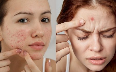 முகப்பரு Vs பருக்கள்: உண்மையான வேறுபாடு என்ன மற்றும் அது ஏன் முக்கியமானது