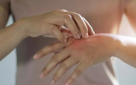 தோல் அரிப்பு பிரச்சனையா? இந்த டிப்ஸ் ஃபாலோ பண்ணுங்க, அறிகுறி குறையும்